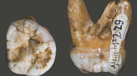 The molar tooth of a Denisovan