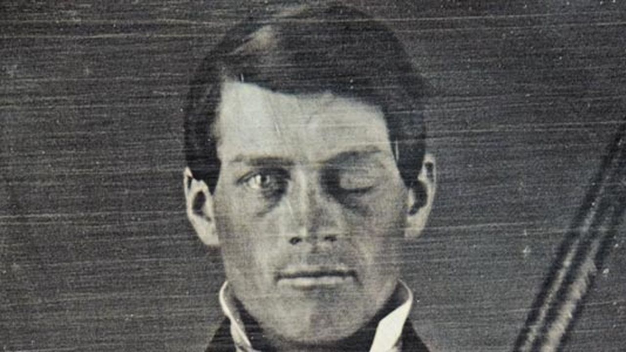 Phineas Gage: Neuroscience