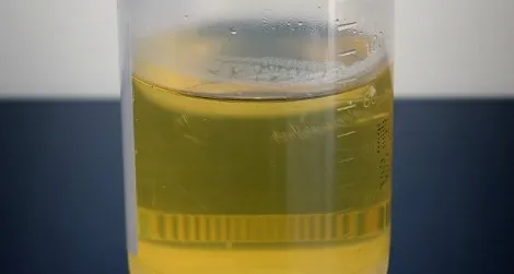 urine