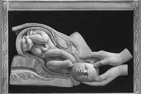 A plate from the Birth Atlas, the Maternity Center Association&#39;s manual depicting the entire Birth
Series using photography and line plate drawing