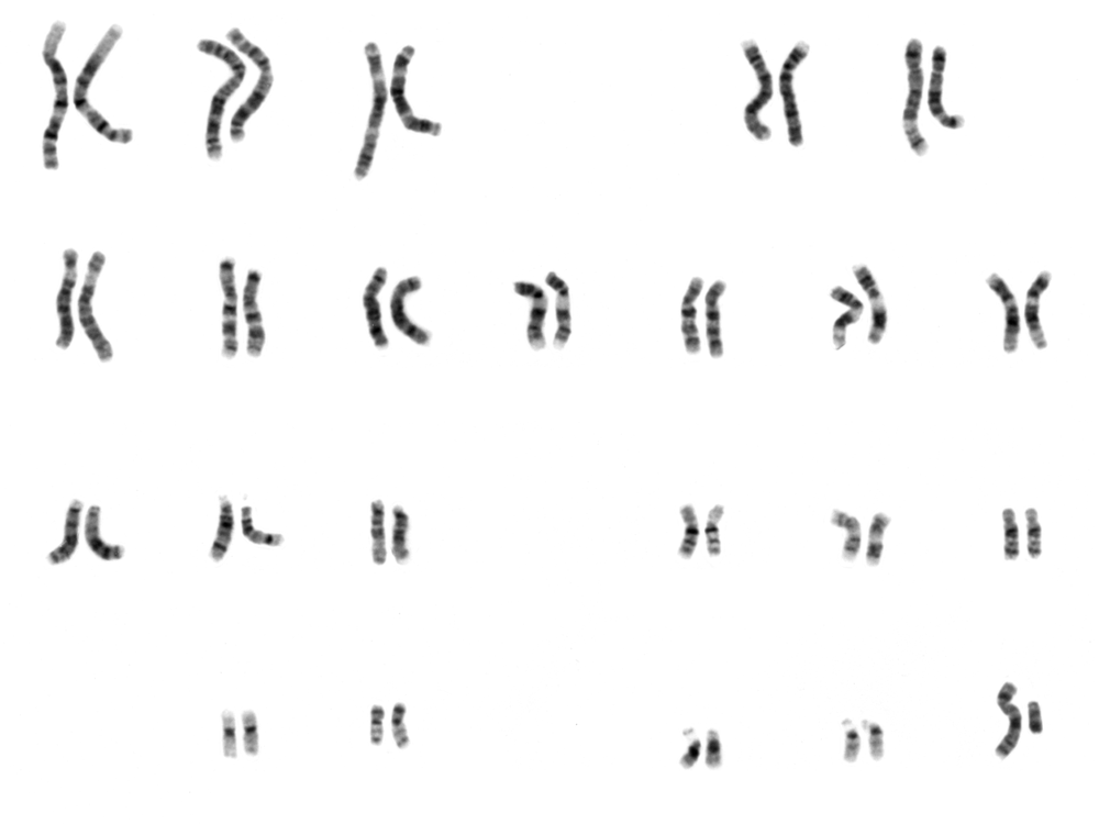 A photograph of a male's chromosomes