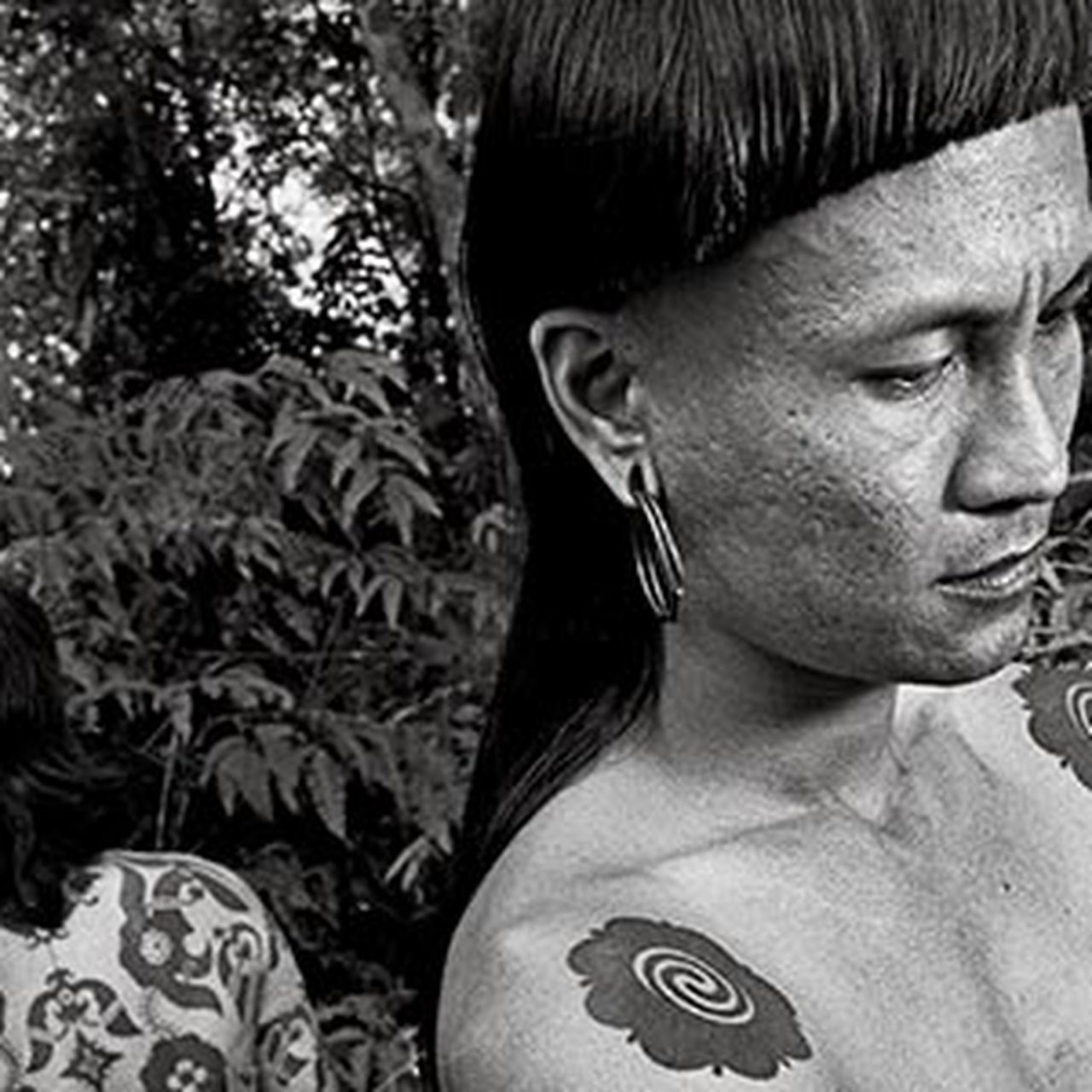 Vol. 1: Top 18 Tattoo Cover Ups – Before and After Tattoo Removal, image size:1280x1280