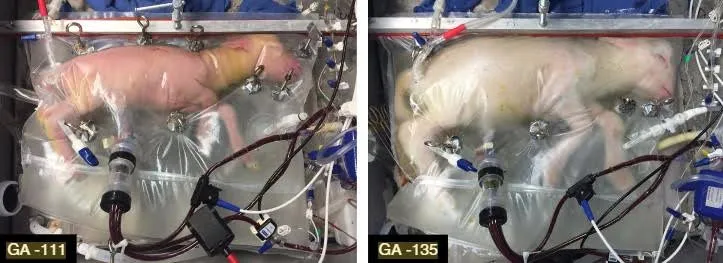 Will This Artificial Womb One Day Improve the Care of Preemies?