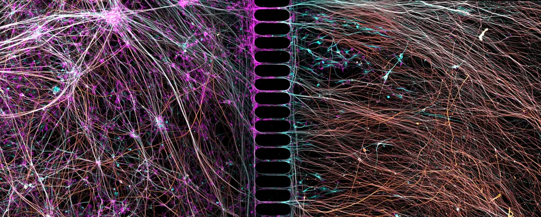 Human neurons growing in chamber
