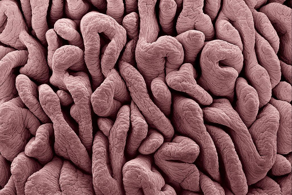 Intestines
