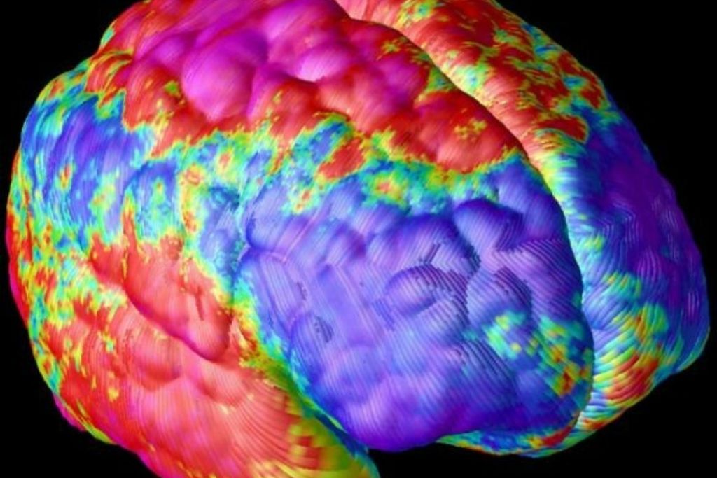 Brain