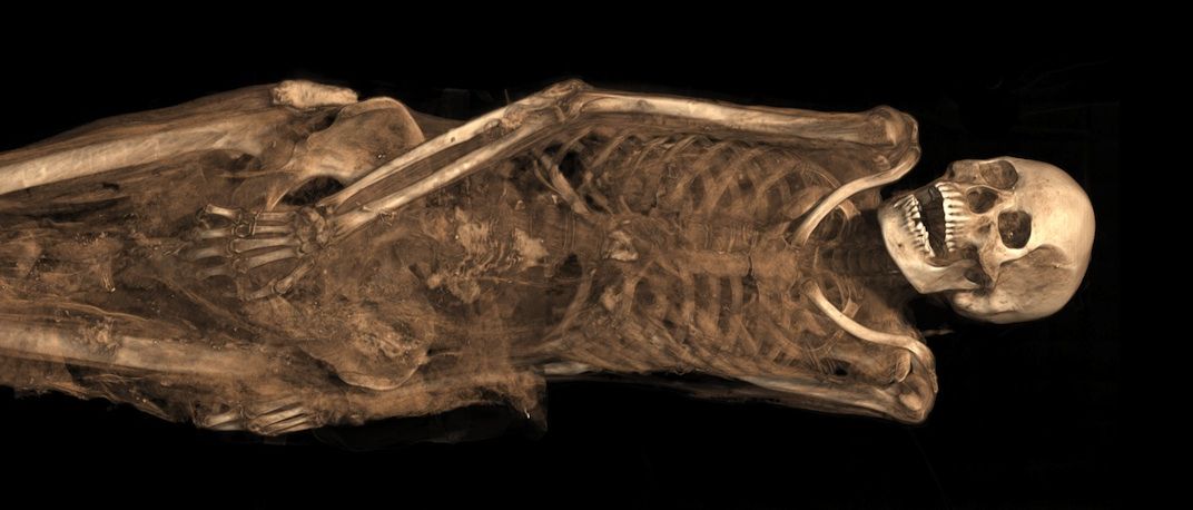 This Mummy Had an Angel Tattooed on Her Leg | Smart News| Smithsonian  Magazine