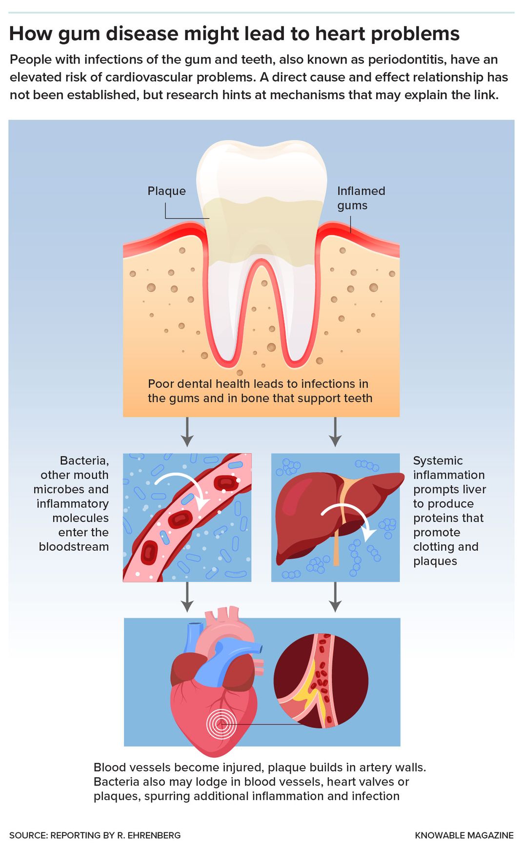 Gum Disease and Heart Problems Graphic