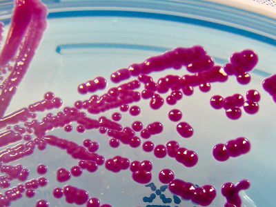 As part of a bioweapon experiment, Serratia marcescens (pictured on an agar plate above) was released in San Francisco back in 1950. 