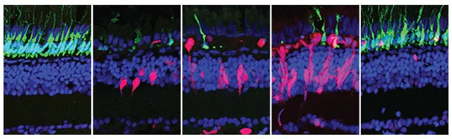 Could the Tiny Zebrafish Teach Us to Cure Blindness?