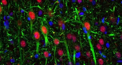 Brain cells, stained in red, are sensitive to hormones that influence appetite