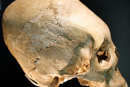 A modified human skull from the early 6th century