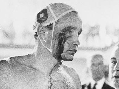 Hungarian water polo player Ervin Zador's eye is injured during the closing minutes of a game against the Soviets.