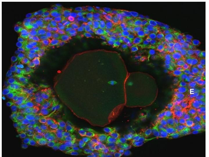 Lab-grown human egg