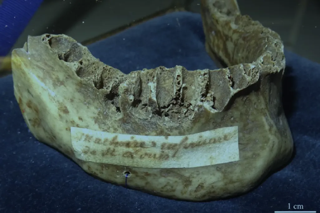 King Louis' Jaw