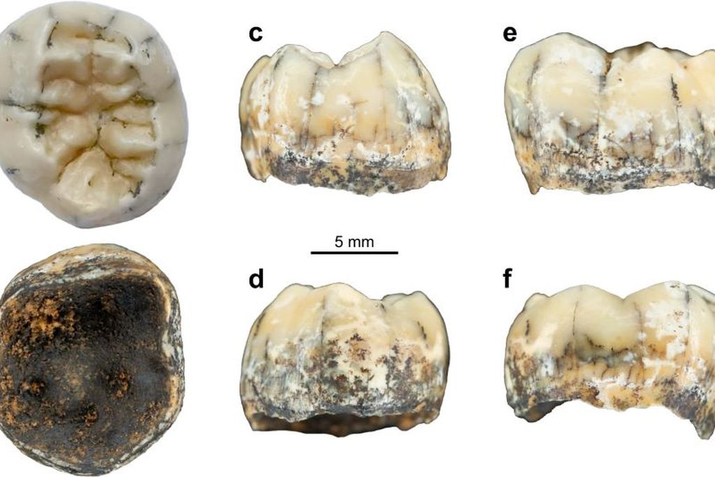 Six images of a tooth from different angles