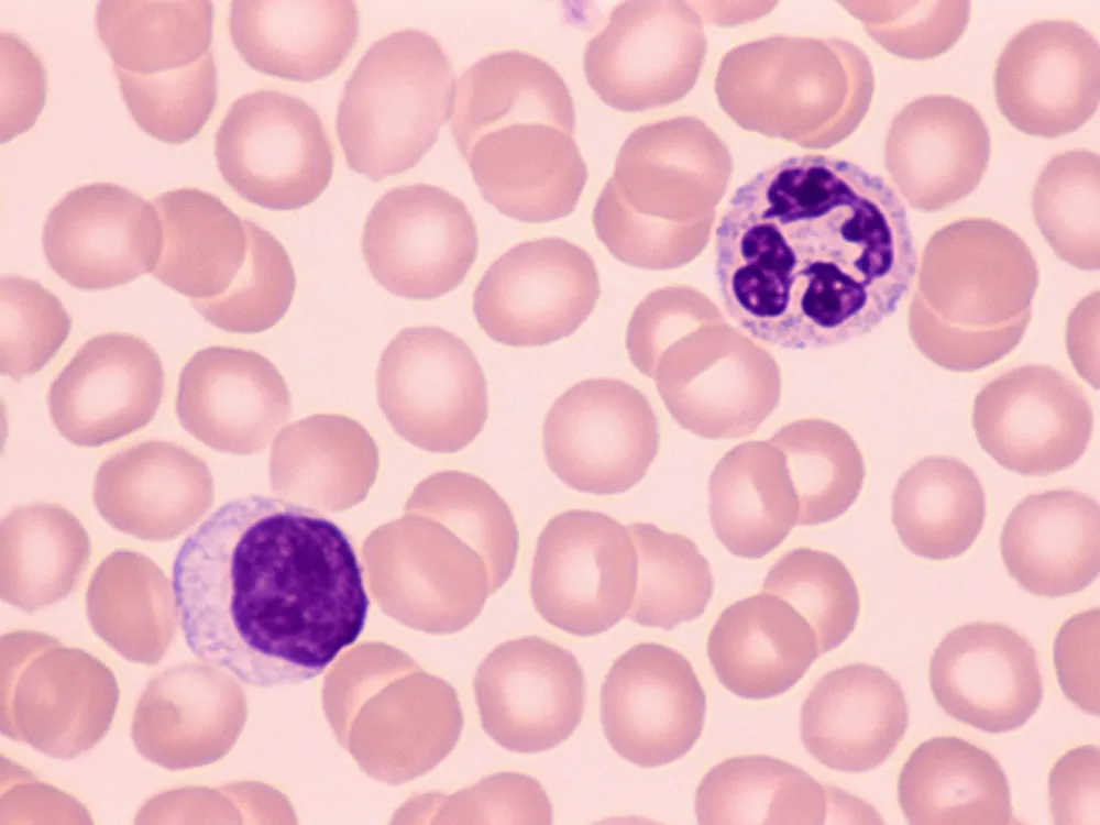 Two stained purple human cells