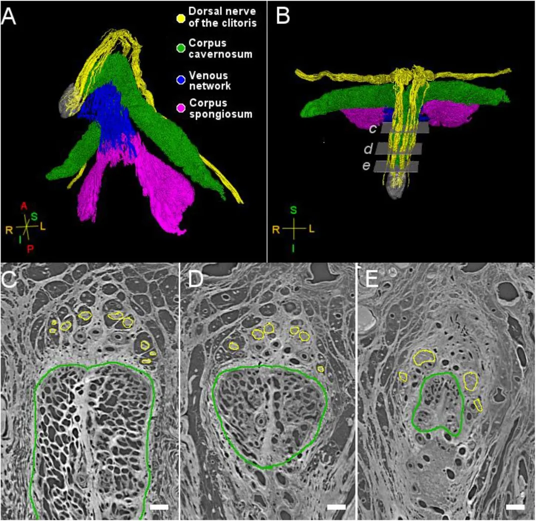 various images of the clitoris with different colors highlighting different parts