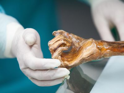 A researcher examines the mummified hand of Ötzi the Iceman.