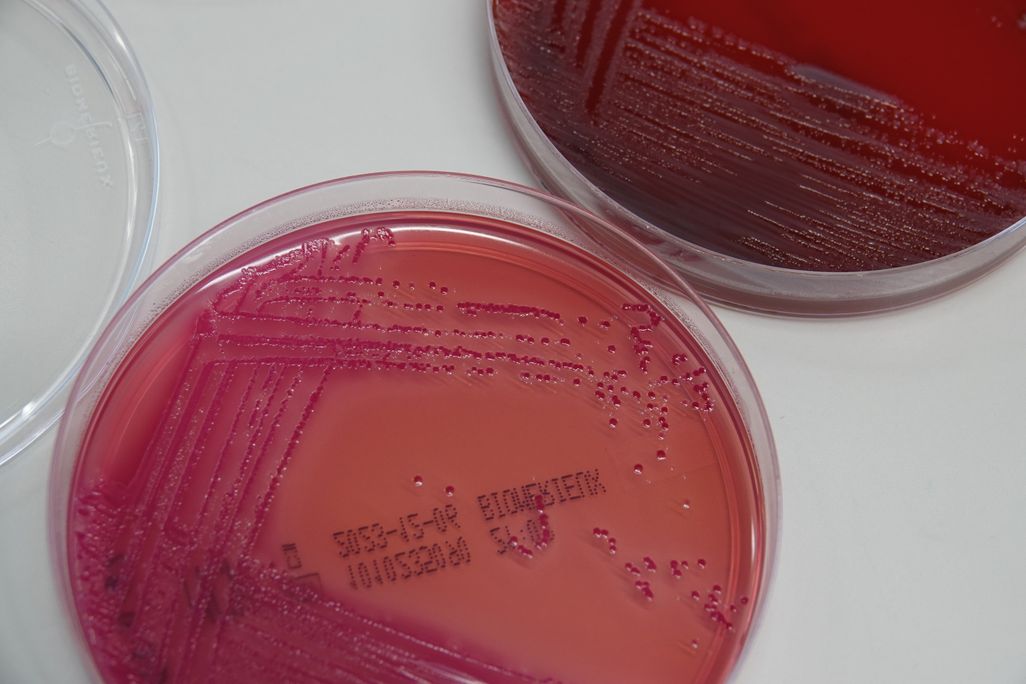 A petri dish with bacteria in a red-colored culture medium