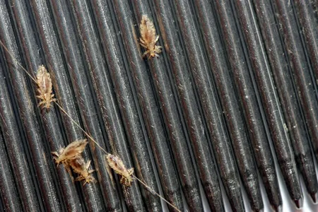 Head lice crawl across a nit comb and into your nightmares.