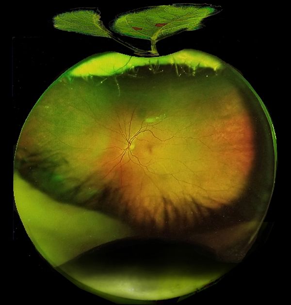 Apple of My Eye thumbnail