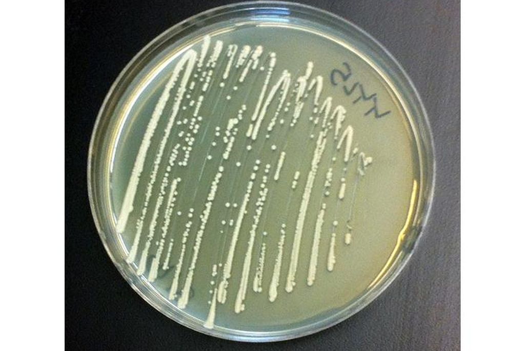 yeast-plate.jpg
