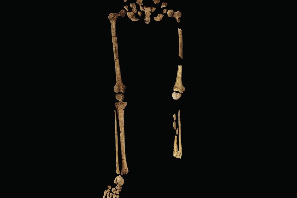 Earliest Known Amputation Skeleton