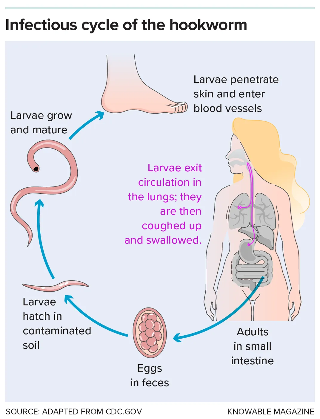 Hookworm Infographic
