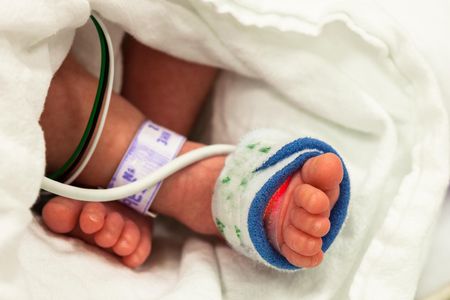 The baby, whose name is Itzmara, (Not Pictured) was delivered via C-section at 37 weeks, three weeks shy of full term because doctors feared that the fetus inside her, which was still growing, would crush her internal organs.