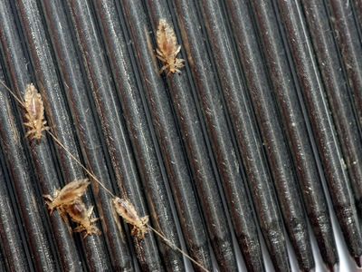 Head lice crawl across a nit comb and into your nightmares.