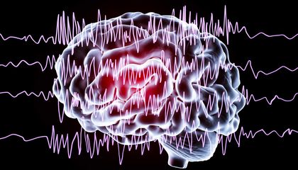 Some People Experience Blissful Ecstasy Right Before a Seizure. Could Understanding This Feeling Help Treat Depression?