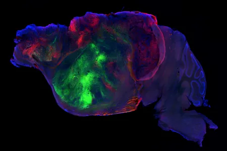 A side view of a "xenocortical" mouse brain, with the grafted human tissue seen in green and red.