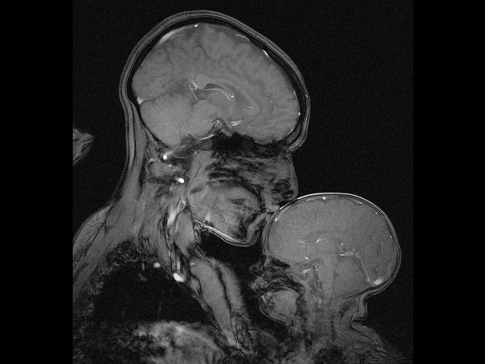 Why I Captured This Mri Of A Mother And Child Science Smithsonian Magazine