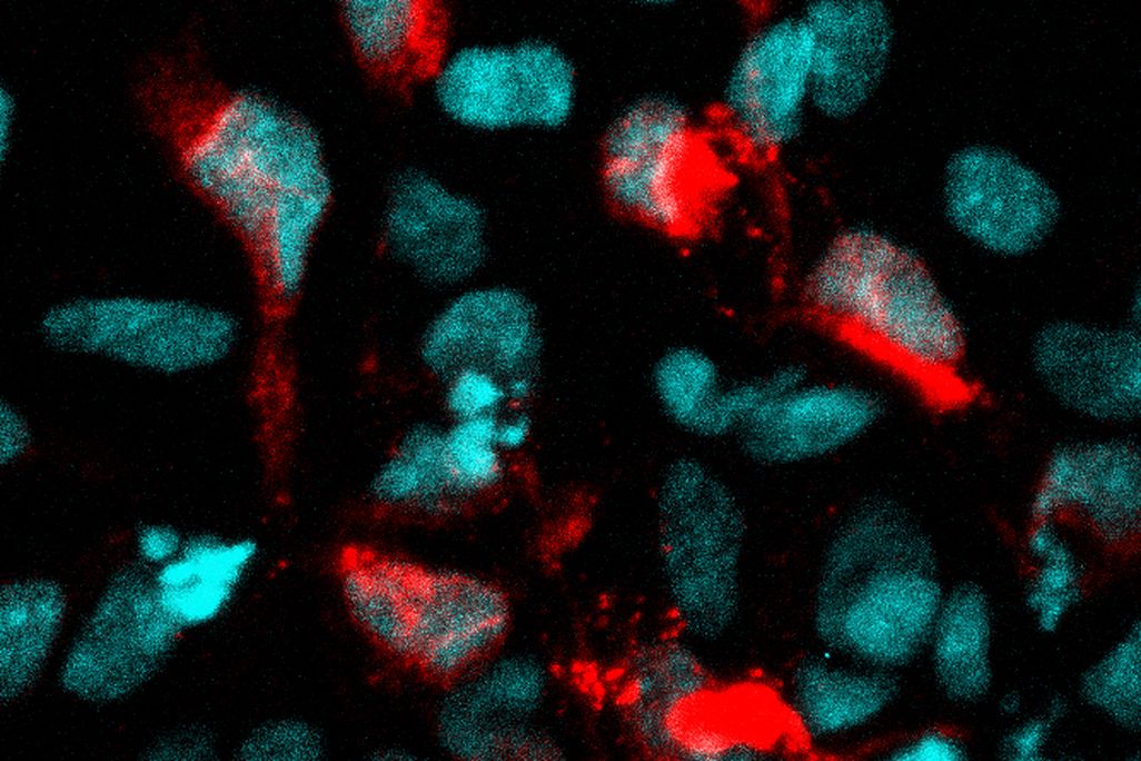 Zika infected cells