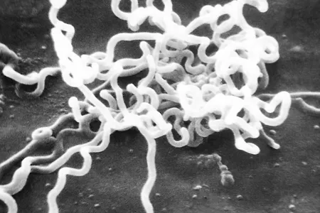 An image from an electron microscope of Treponema pallidum, the bacteria that causes syphilis. In 2022, the number of reported cases of syphilis in the United States was the highest it has been since 1950.