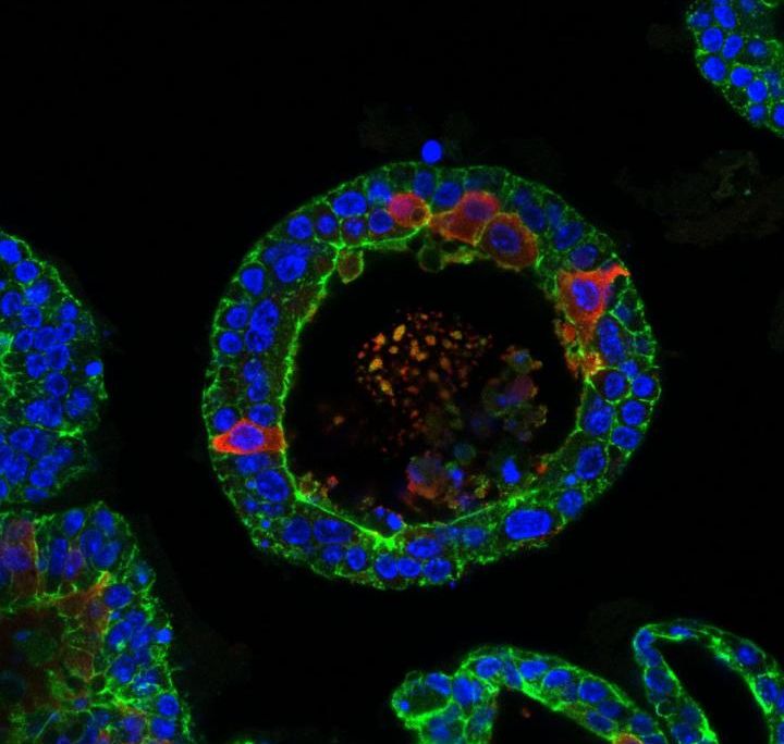 tear gland organoids