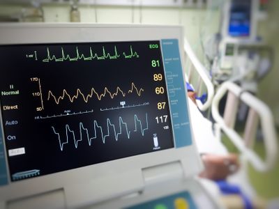 While the peaks and valleys on people's ECGs may look identical to the untrained eye, they’re actually anything but.