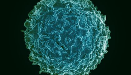 In a First, This Personalized Cell Therapy Treated Three Life-Threatening Autoimmune Diseases in One Patient