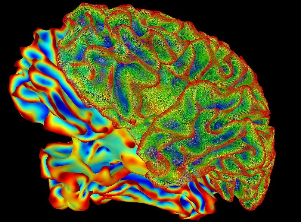 brain fmri scan