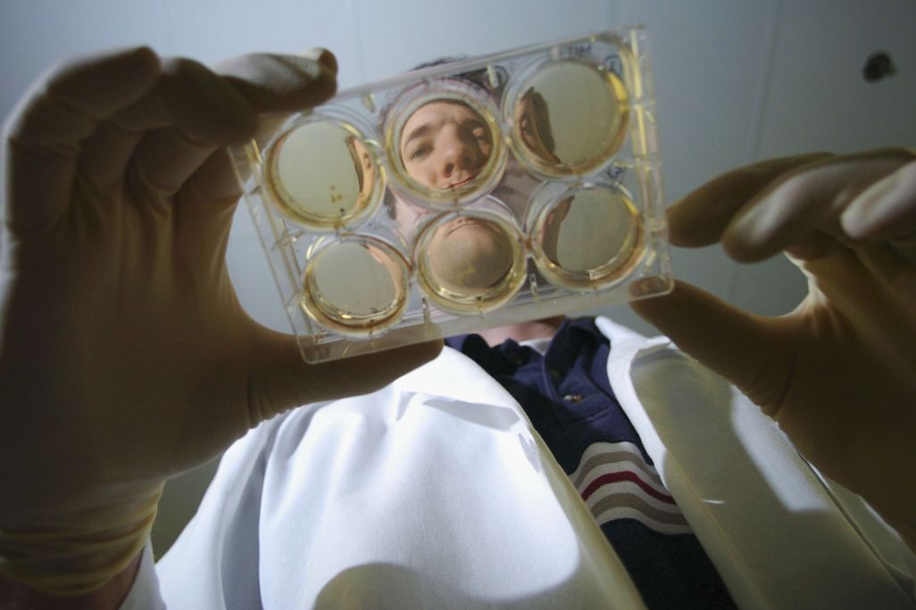 The face of a researcher is seen through a plate of cultures they are holding