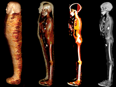 The mummified teen digitally unwrapped in four stages