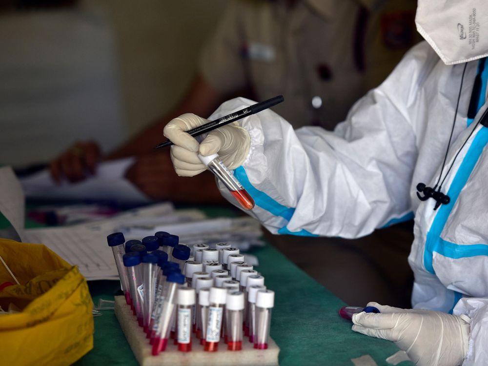  A health worker preserves swab samples at a Covid-19 testing center in New Delhi, India. 