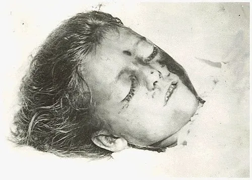 A postmortem photo of Little Miss 1565, an unidentified victim of the Hartford circus fire