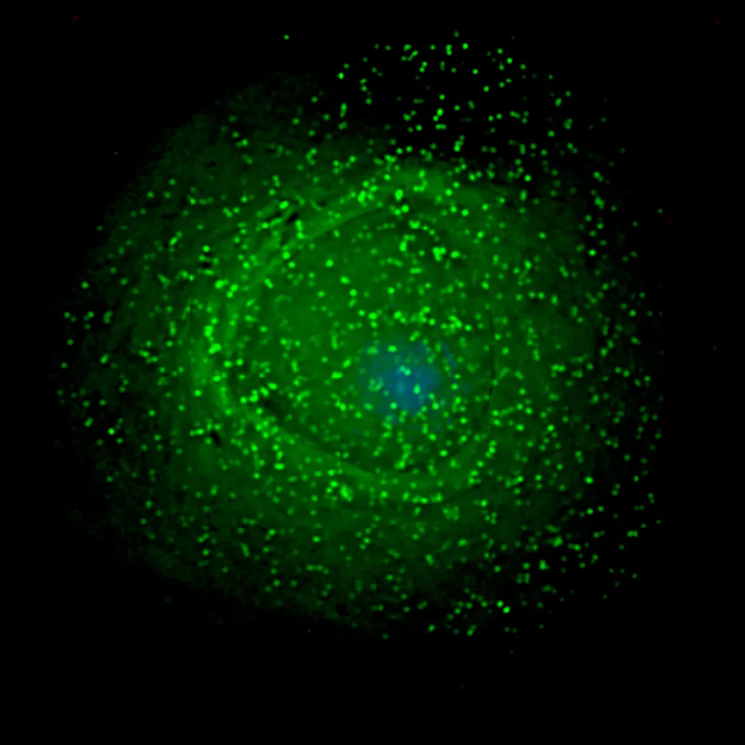 HIV Macrophage