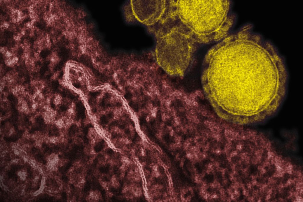 05_06_2014_MERS.jpg