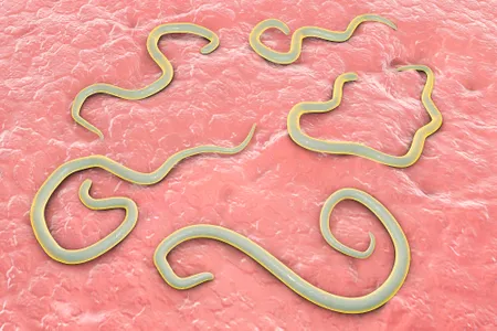 A computer illustration details dog roundworm (Toxocara canis). Humans can pick up the parasite when coming into contact with infected soil or feces.