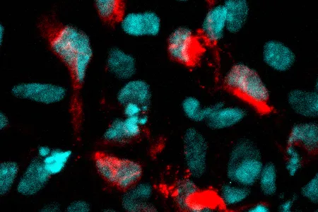 Human brain cells infected by the Zika virus (in red). 
