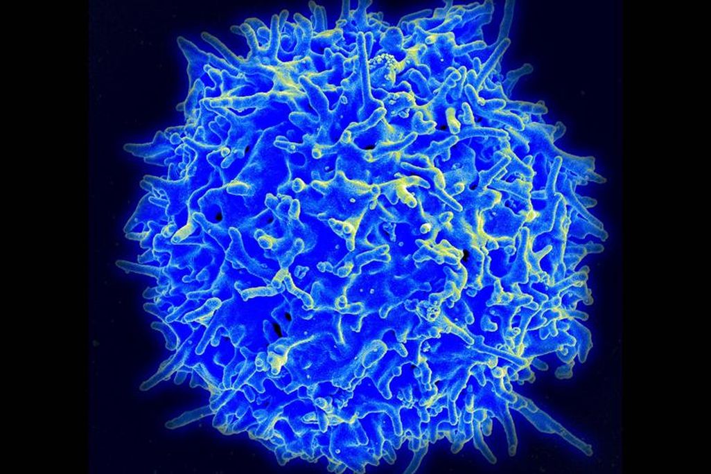 Human T-Cell NIAID.jpg