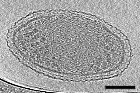 More than 150,000 of these tiny bacterial cells could fit onto the tip of a human hair. 